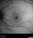 nasal-brao_inmur_031618_07.jpg