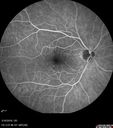 nasal-brao_inmur_031618_09.jpg