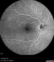 nasal-brao_inmur_031618_10.jpg
