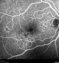patterndys_husmi_021816_07.jpg