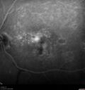 patterndys_husmi_021816_16.jpg
