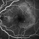 pcv_pulpoly_caga_030714_18.jpg