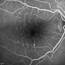 pcv_pulpoly_caga_030714_22.jpg