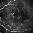pcv_pulpoly_caga_030714_25.jpg