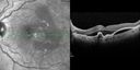 pcv_pulpoly_caga_040714_Peylea01.jpg