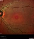 plaquenil_4yr_chfra_111819_04.jpg