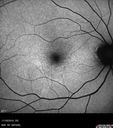 plaquenil_4yr_chfra_111819_07.jpg