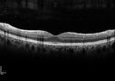 pucker-pamm_nawa1__OD_080614_001.jpg