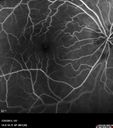 pucker_moderate_crto_15.jpg