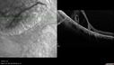 retinoschisis-st-mysh-010214_001.jpg