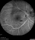 Filename=rothspot-anemia_117768_112123_06.jpg
Filesize=82KiB
Dimensions=768x868
Date added=Aug 13, 2025 rothspot-anemia_117768_112123_06.jpg