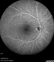 Filename=rvo-venousMA-pepiaz_14.jpg
Filesize=88KiB
Dimensions=768x868
Date added=Mar 19, 2023 rvo-venousMA-pepiaz_14.jpg