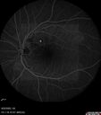 Filename=rvo-venousMA-pepiaz_22.jpg
Filesize=44KiB
Dimensions=768x868
Date added=Mar 19, 2023 rvo-venousMA-pepiaz_22.jpg