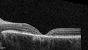stargardts_2020_105079_07.jpg