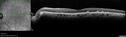 wetAMD-Classic_becos_082420__10.jpg