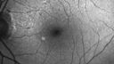 Filename=wetAMD_gamus_061422_04.jpg
Filesize=109KiB
Dimensions=768x432
Date added=Jan 17, 2023 wetAMD_gamus_061422_04.jpg
