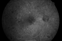 pdr_nve_51677_281629.png