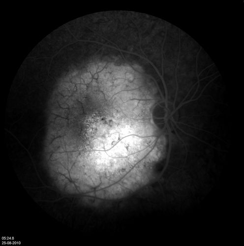 retinagallery_285529.jpg