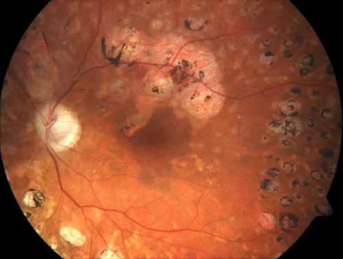 Retina_28129.jpg
