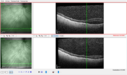 srfluid_pason_042318_12.PNG