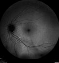 srfluid_pason_042318_16.jpg
