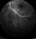 srfluid_pason_042318_19.jpg