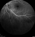 srfluid_pason_042318_23.jpg