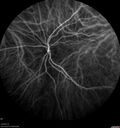 srfluid_pason_042318_26.jpg