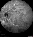 srfluid_pason_042318_30.jpg