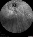 srfluid_pason_042318_31.jpg